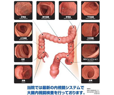 大腸癌発見部位